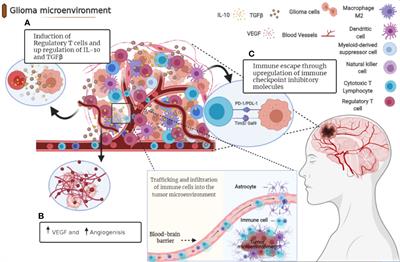 Immune Checkpoint Inhibitors in Human Glioma Microenvironment